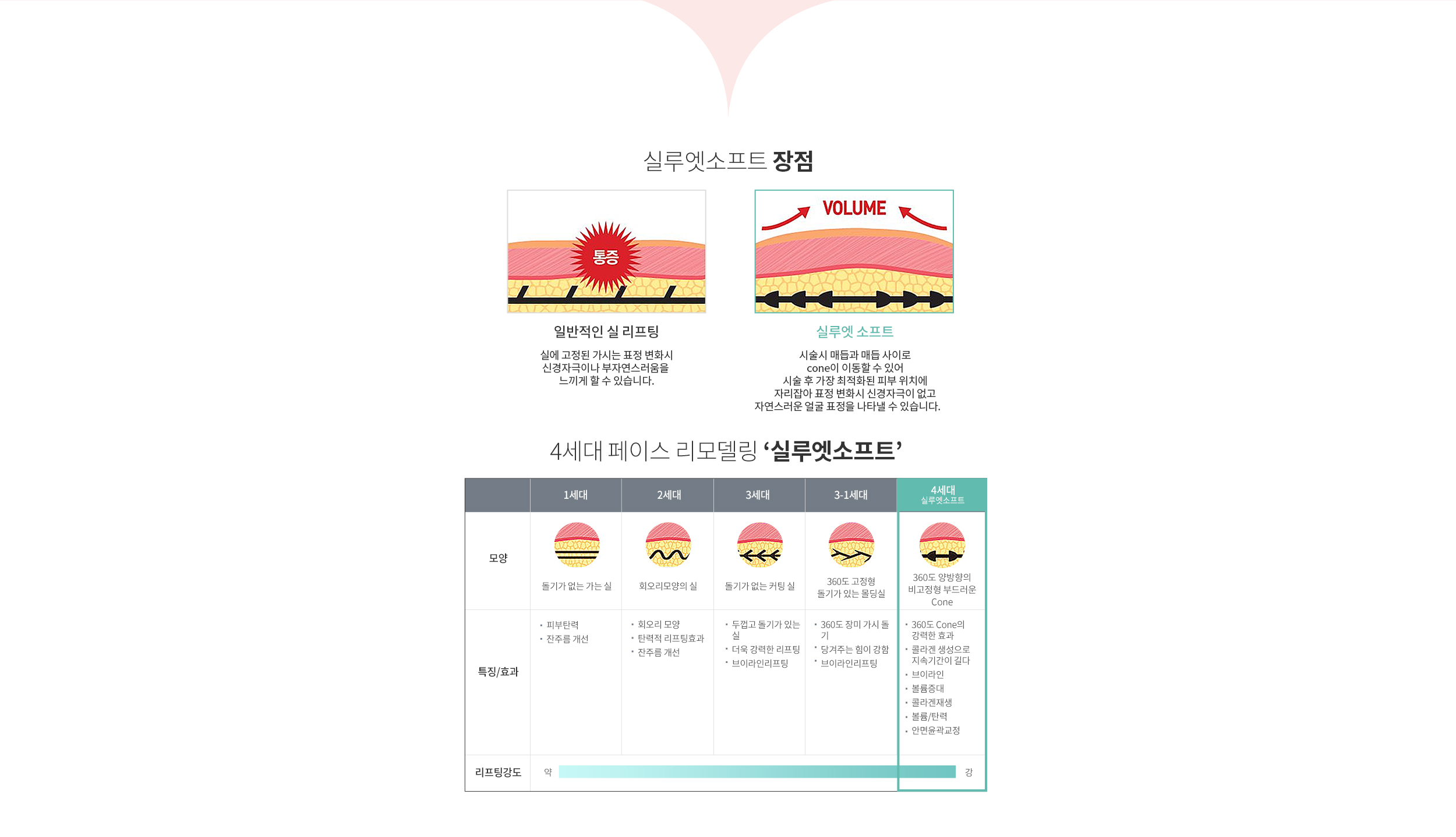 실루엣소프트 장점 / 4세대 페이스 리모델링