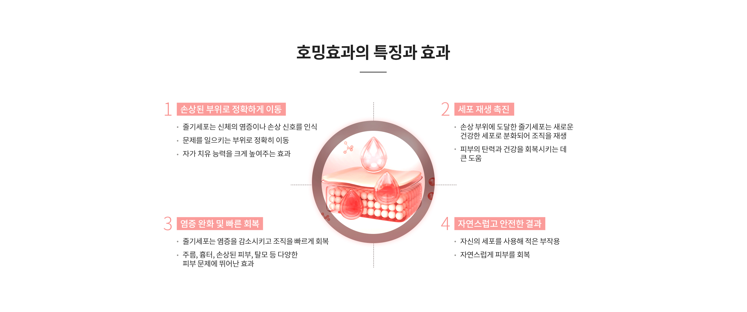 줄기세포 호밍효과의 특징와 효과