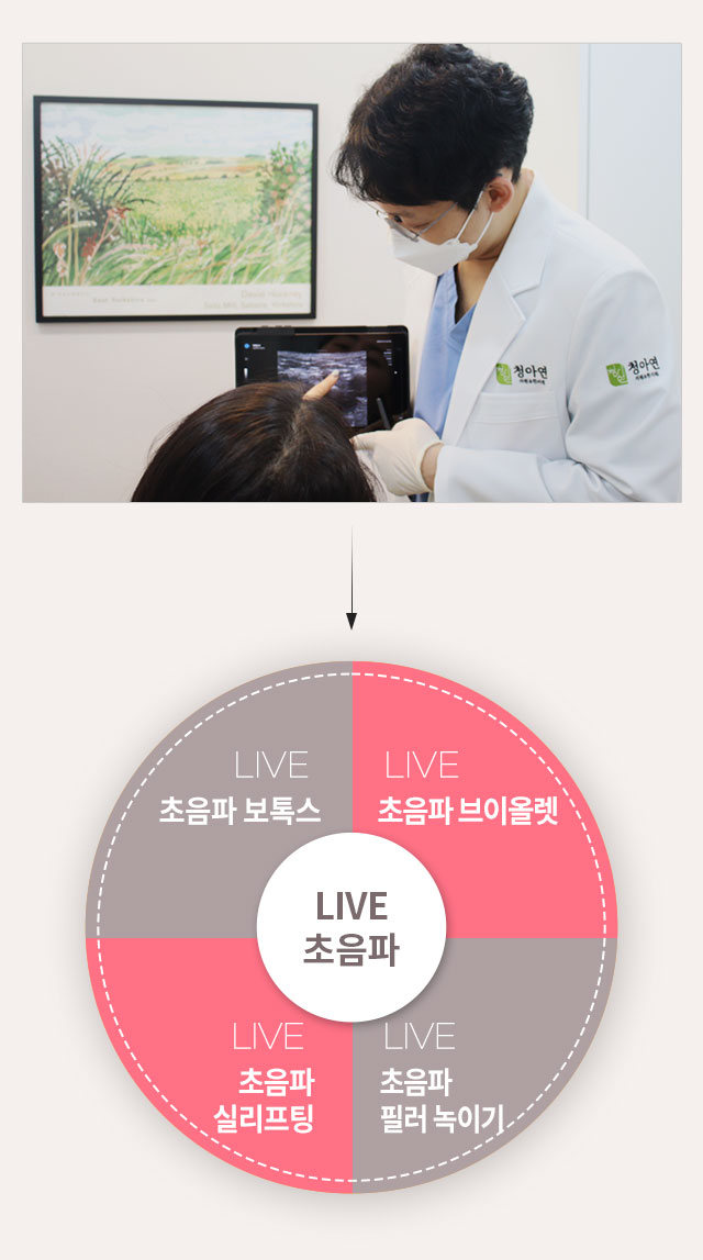 라이브 초음파 시술 종류