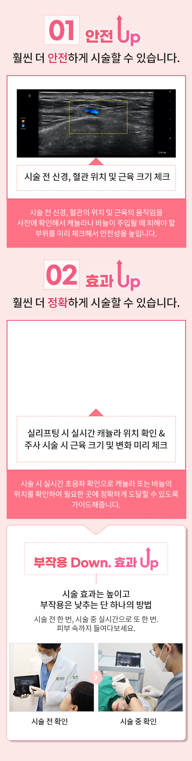 라이브 초음파 시술이 필요한 이유