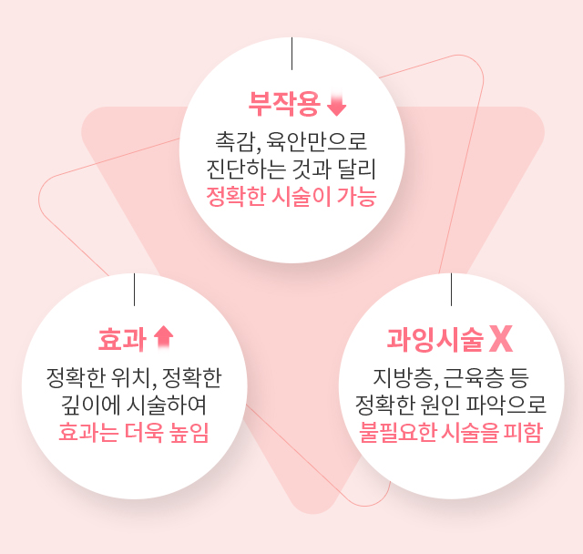 초음파 진단 효과