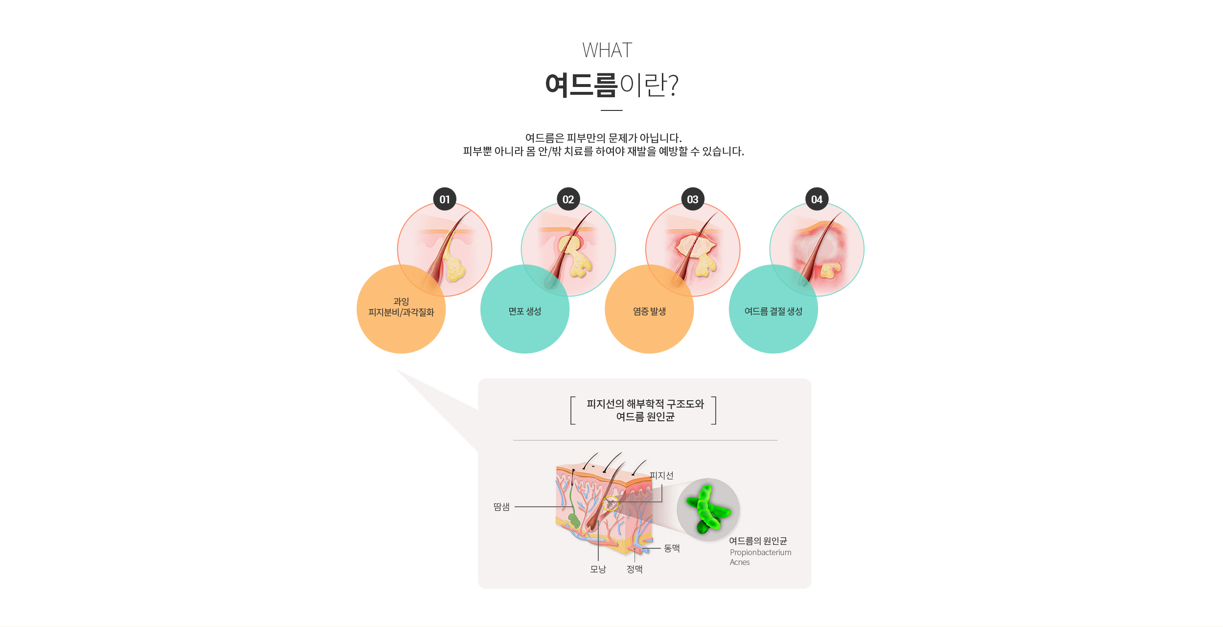 여드름이란? / 해부학정 구조도와 여드름 원인균