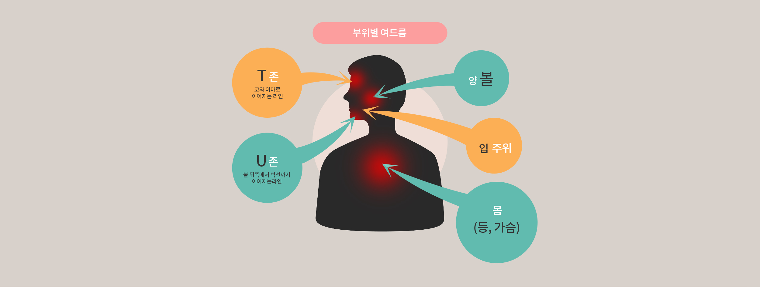 부위별 여드름