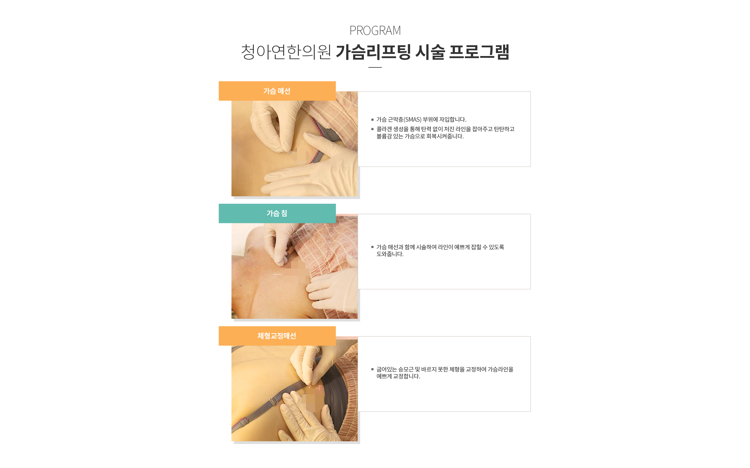 청아연한의원 가슴리프팅 시술 프로그램